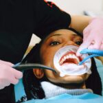 Quais os cuidados após um clareamento dental?